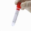 Clot Activator Tube with Coagulant for Blood Biochemistry Examination