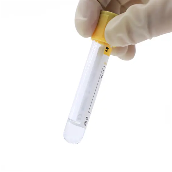 1745396019198 Gel & Clot Activator Tube for Biochemistry Examination